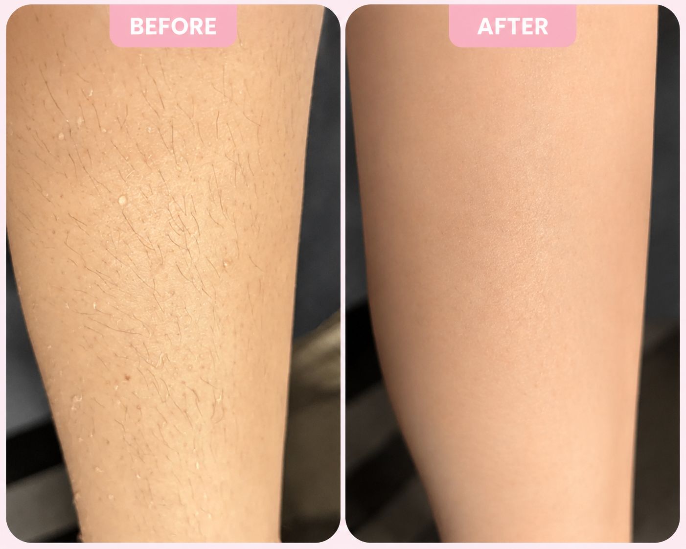 LuneBare™ – 2-in-1 Women’s Body Shaver