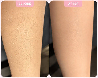 LuneBare™ – 2-in-1 Women’s Body Shaver
