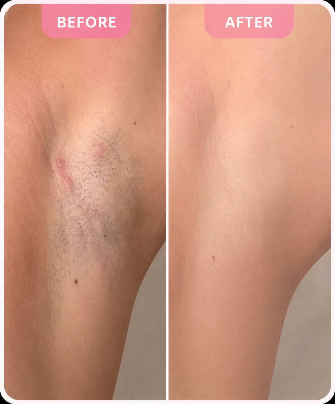 LuneBare™ – 2-in-1 Women’s Body Shaver