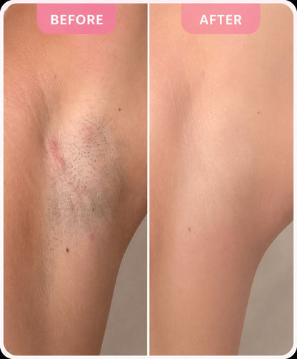 LuneBare™ – 2-in-1 Women’s Body Shaver